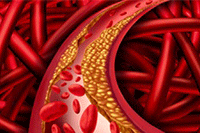 �Ա�������̳�:�����ıҪ����Щ���ܺ��ĸ��汾