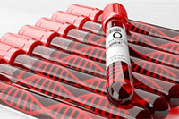 �Ա�ֱ����ͨ��ᱻ�ر���,Ϊʲô�ᱻ�ر�